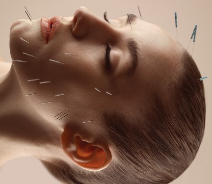 NUVO Magazine: Cosmetic Acupuncture